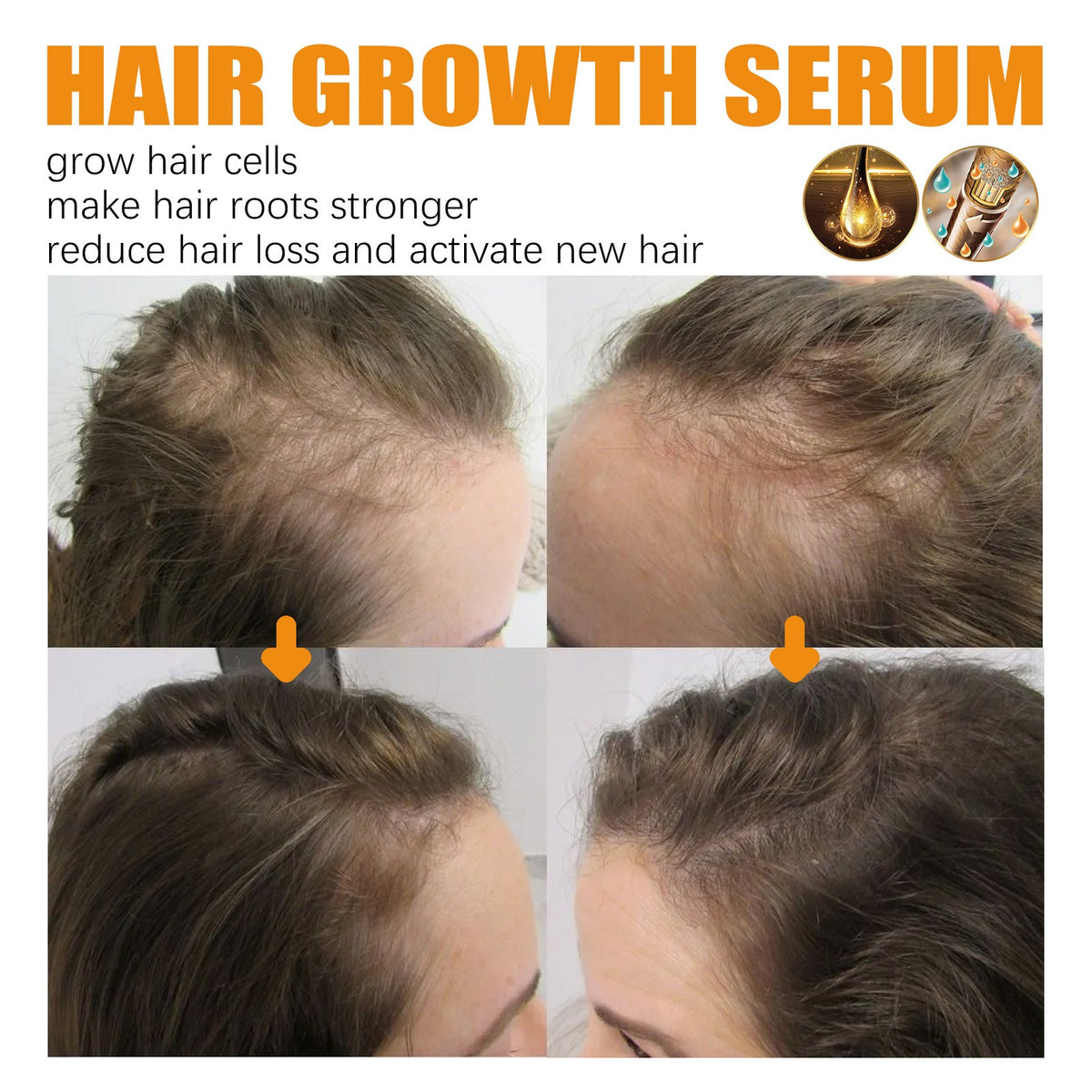 30ml Hair Growth Essence for Strong, Thick Hair Care Glow Theory