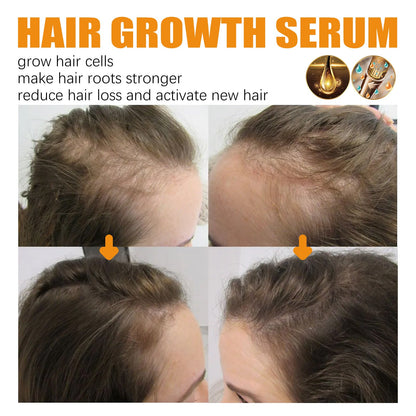 30ml Hair Growth Essence for Strong, Thick Hair Care Glow Theory