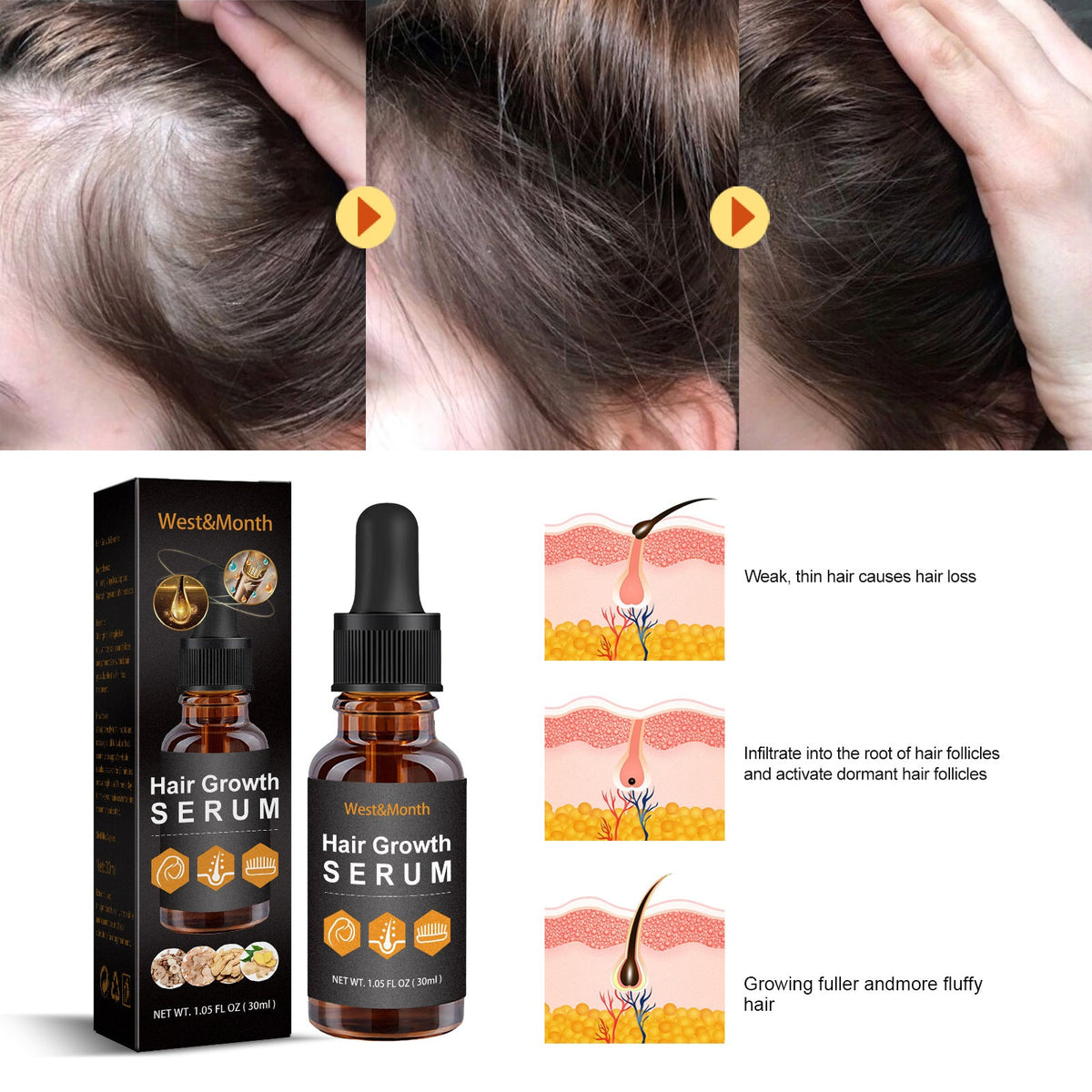 30ml Hair Growth Essence for Strong, Thick Hair Care Glow Theory