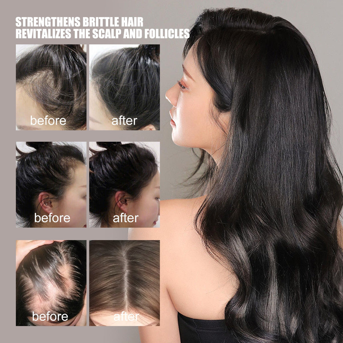 30ml Hair Growth Essence for Strong, Thick Hair Care Glow Theory