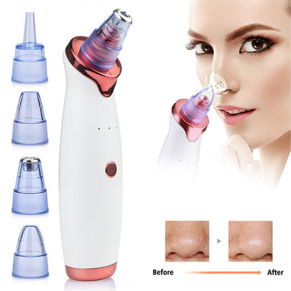 Electric Blackhead Remover Vacuum Health & Beauty-6